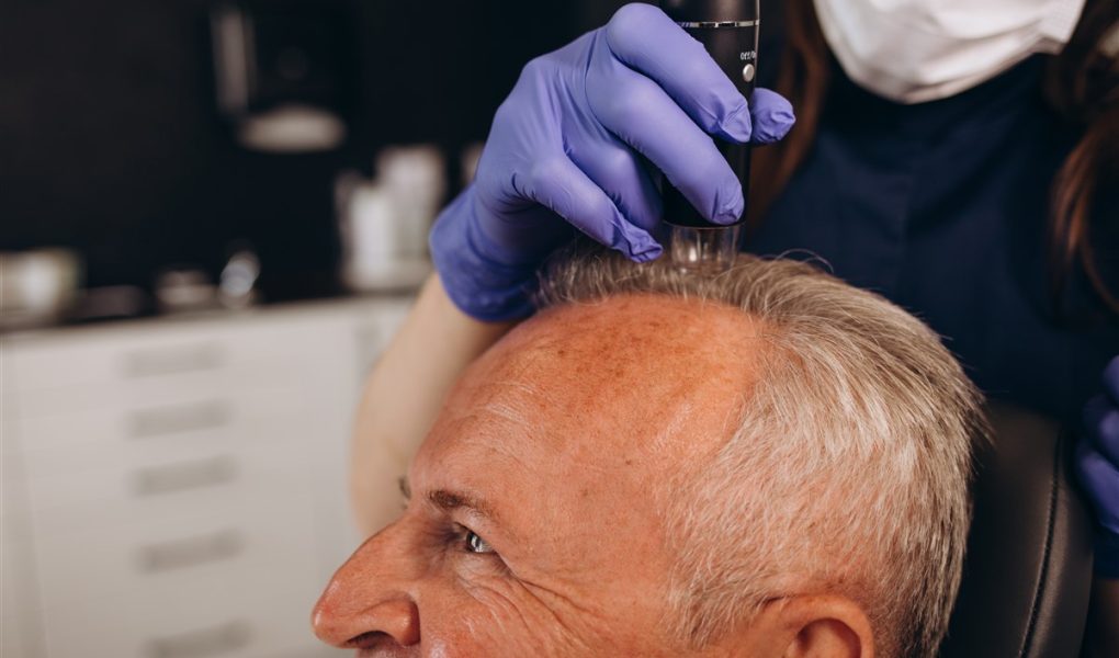 technique de pointe en greffe de cheveux