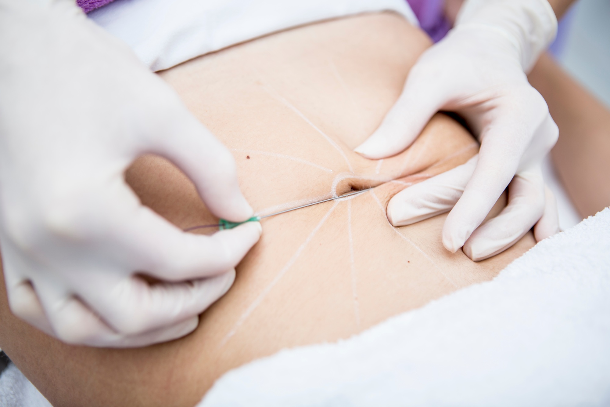 parler avec médecin
